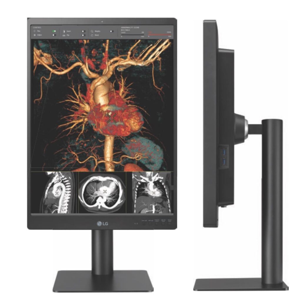 A vertical diagnostic monitor screen
