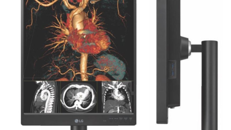 A vertical diagnostic monitor screen