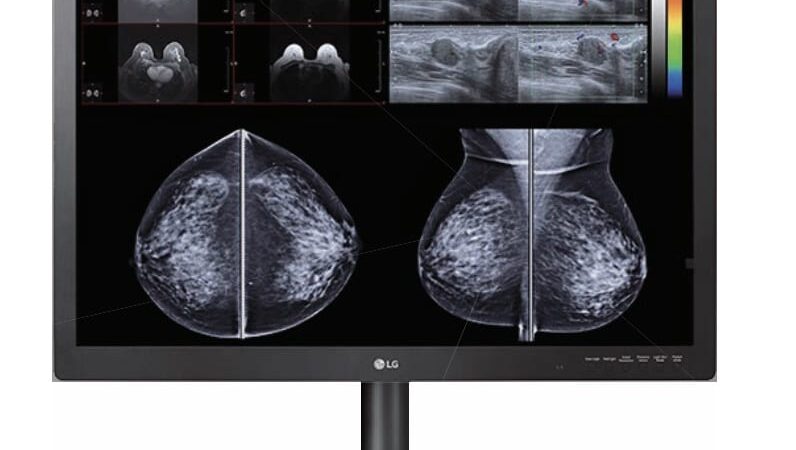 Diagnostic monitor screen