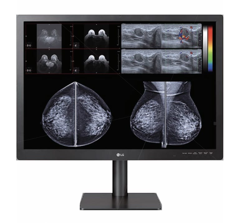 Diagnostic monitor screen