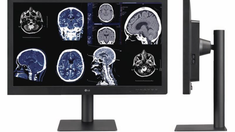 LG Diagnostics Monitor